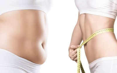 Liposuction Surgery Before and After