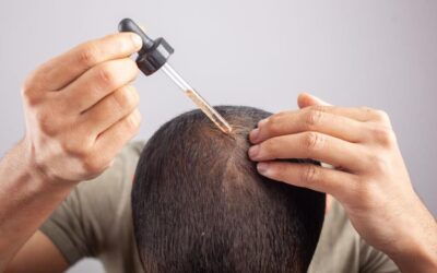 Minoxidil 5% for Hair Loss Regrowth Treatment