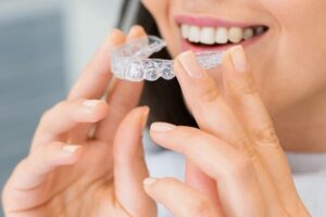 Using invisible aligners