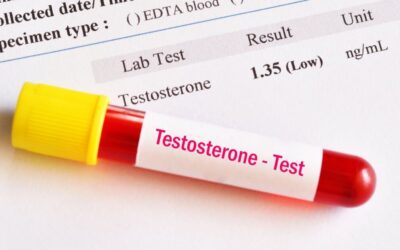 Testosterone Testing