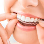 Your Dental Staff’s Role in Clear Aligner Care