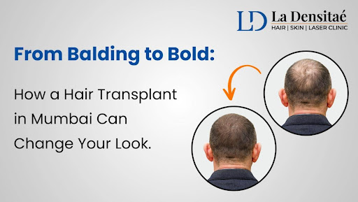How a Hair Transplant in Mumbai Can Change Your Look