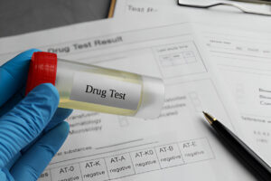 Does an Annual Physical Include a Drug Test in Hartford, CT?