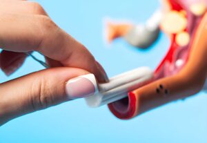 IUD Removal in Hartford, CT: What Women Should Know