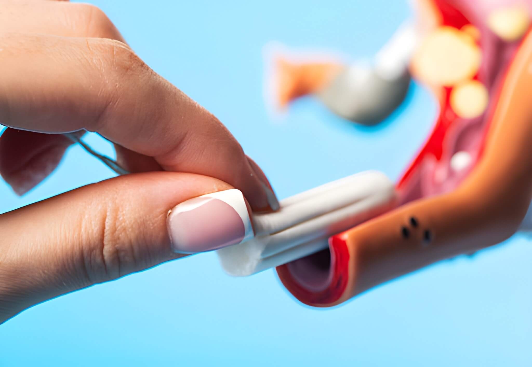 IUD Removal in Hartford