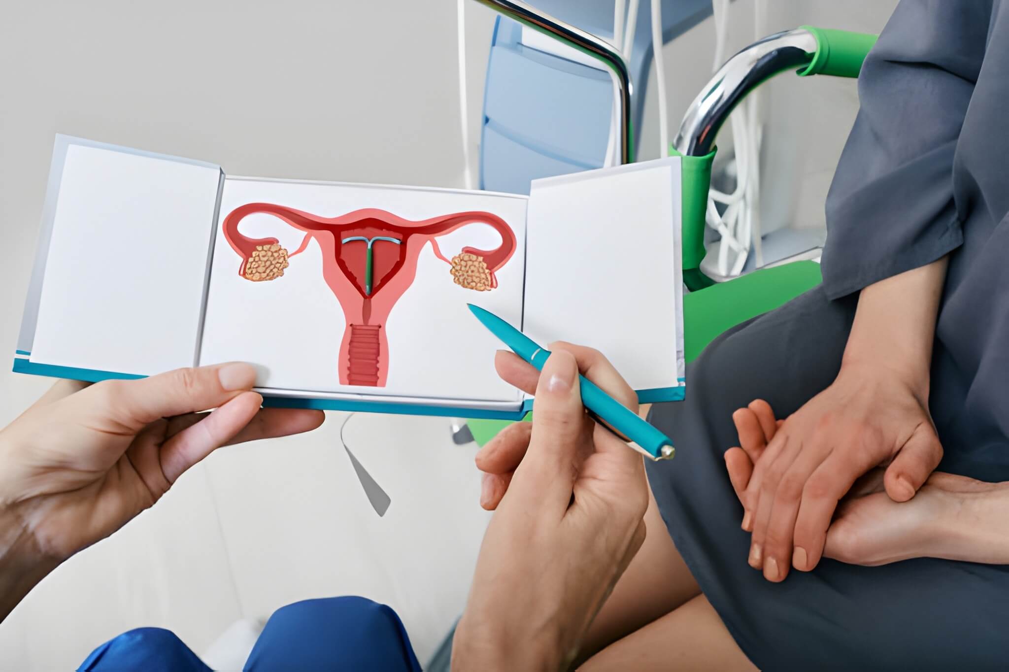 Bleeding for 2 Weeks After IUD Insertion
