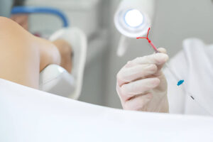 IUD Insertion in Hartford: What to Expect and How to Prepare