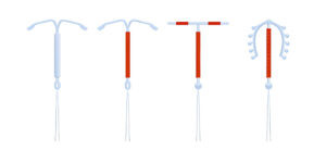 Why Wait 2 Weeks After IUD Mirena: Understanding the Recovery and Aftercare