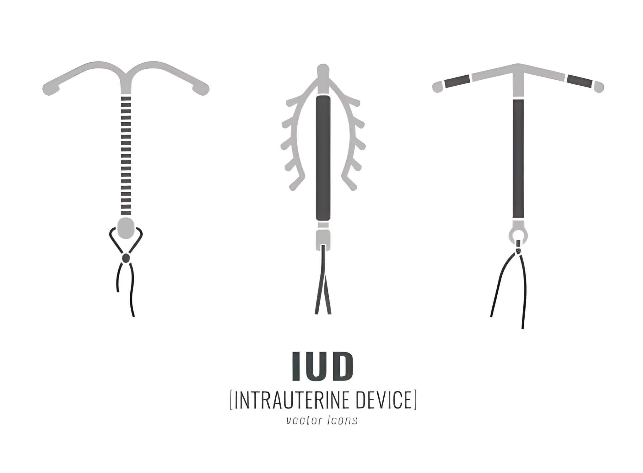 CPT & ICD-10 Codes for IUD Insertion and Removal
